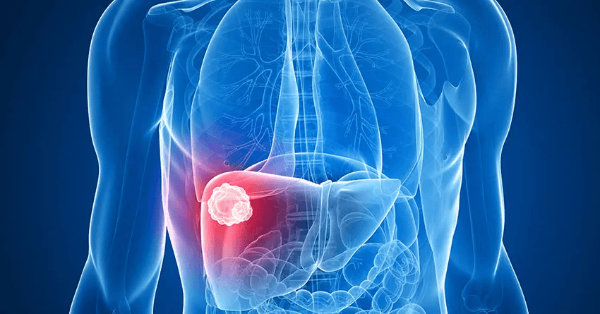 Anand Karna Liver Disease Detection